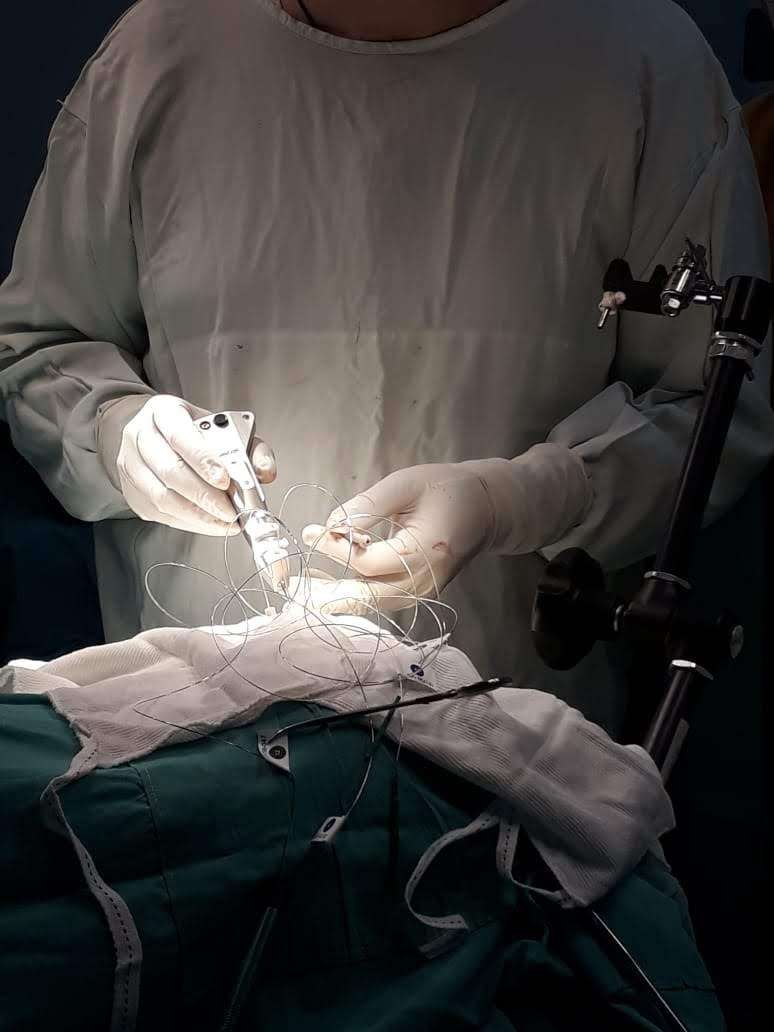 el equipo de cirugia de epilepsia del Hospital Español de Mendoza