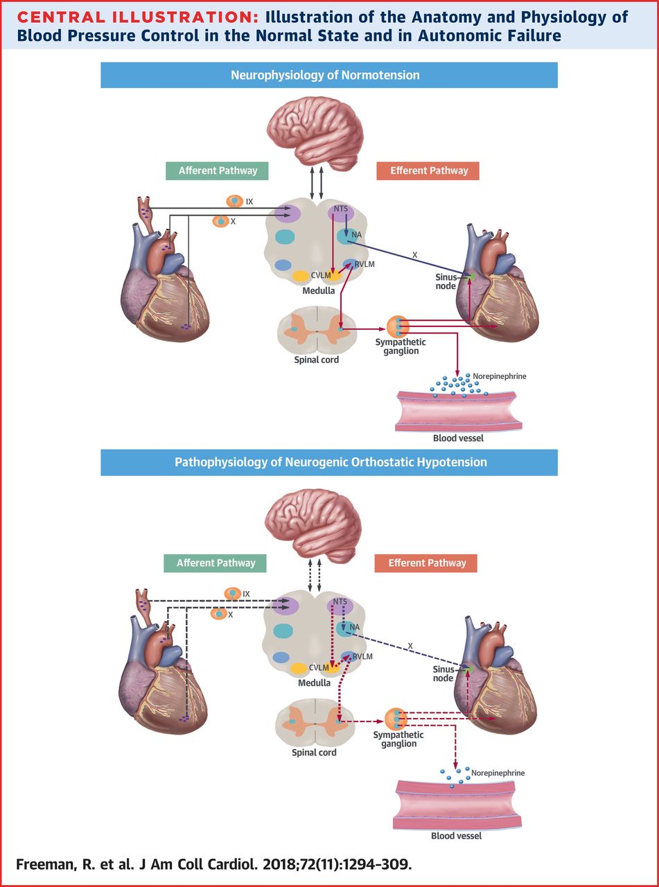 Hipotension ortostatica - IntraMed