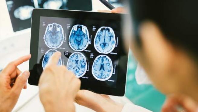 Cerebro El cerebro es uno de los organos mas desconocidos.