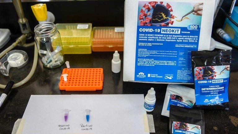 En la Argentina, produciran un millon de test rapidos por mes para la deteccion de coronavirus