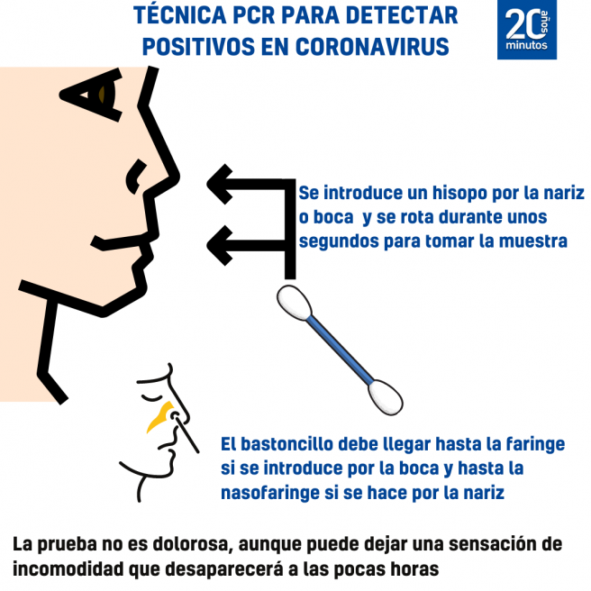 Prueba PCR Prueba PCR.
