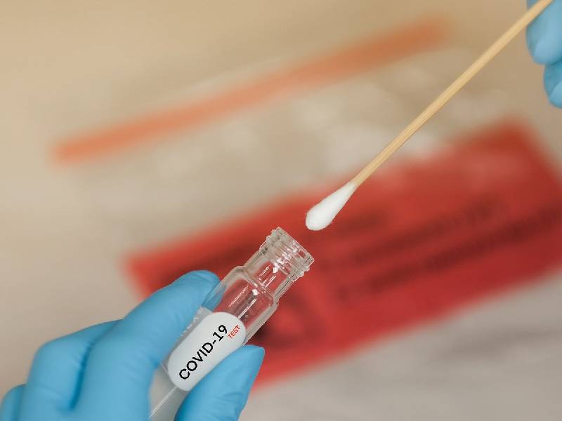 Coronavirus Un estudio comprobo que las muestras de saliva podrian reemplazar al hisopado