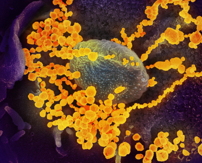 Coronavirus al microscopio Particulas virales de SARS-CoV-2 (amarillo) vistas al microscopio electronico.