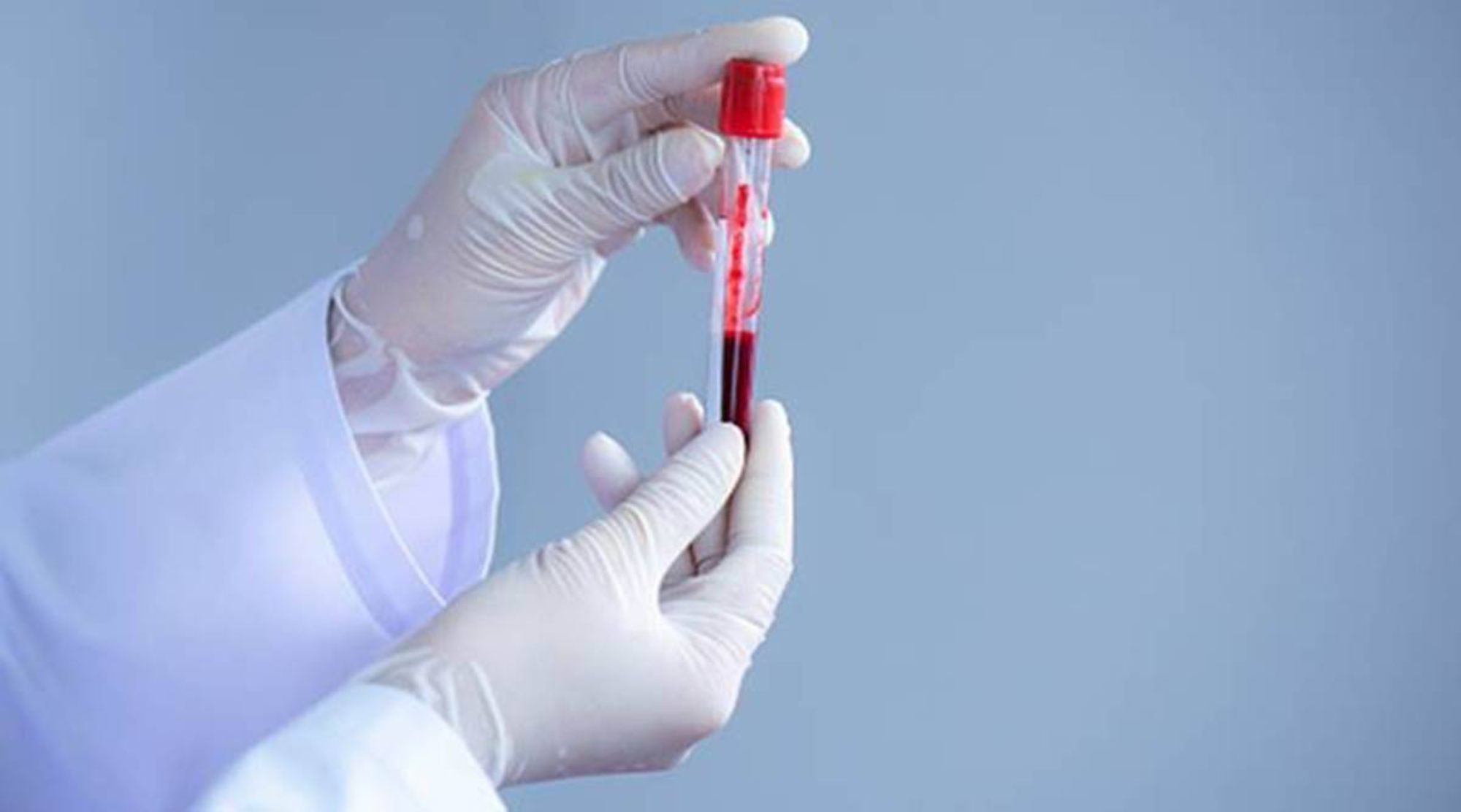Segunda ola de coronavirus: buscan reforzar donacion de plasma de pacientes recuperados