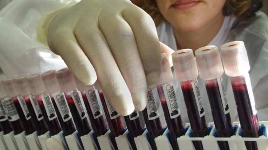 Medico especialista sobre las enfermedades respiratorias:"Casi no hubo gripes gracias al uso del barbijo, no se dejen estar" 4 Enfermedades respiratorias