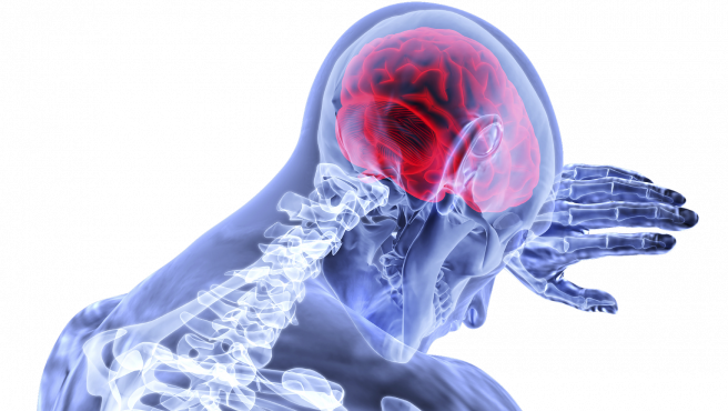 Representacion del cerebro.