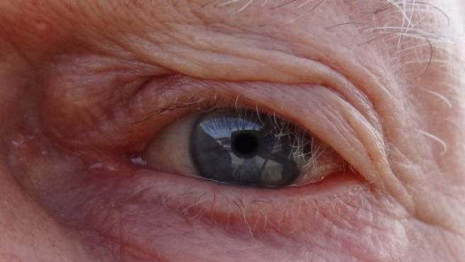Ojo con cataratas
