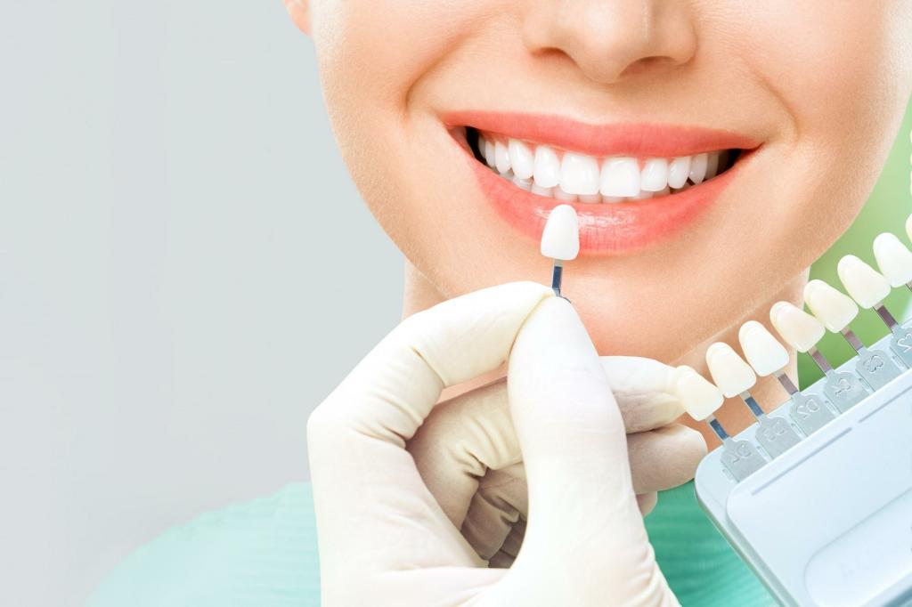 Muestras de dientes con distintas tonalidades. Freepik