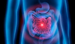 El laxante natural para combatir el estreñimiento en solamente 30 segundos