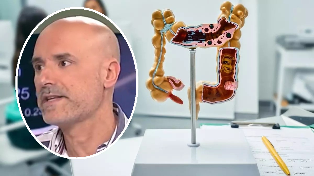 El doctor Fabiani, junto a una maqueta de un colon con cancer.