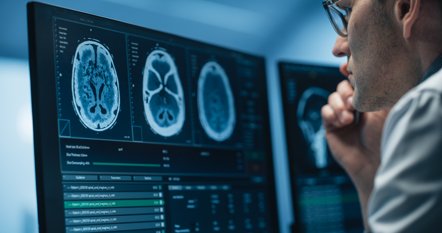 Dos de los cinco casos son meningiomas, el tipo mas comun de tumor cerebral benigno