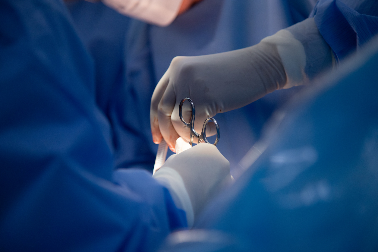 Medicos en un quirofano.