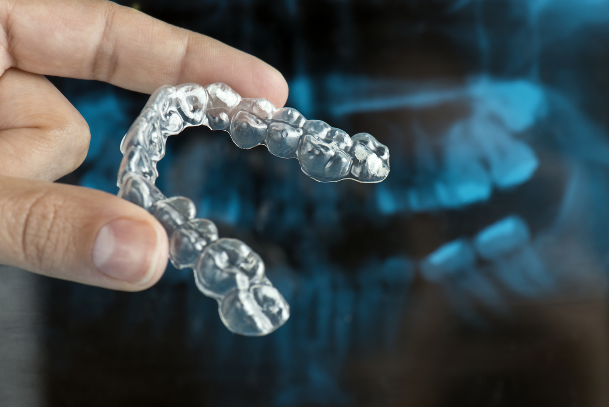 La férula de descarga protege los dientes del desgaste del bruxismo