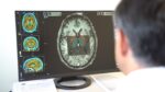 Un estudio de Harvard advierte sobre el tipo de alimentos que pueden aumentar el riesgo de Parkinson