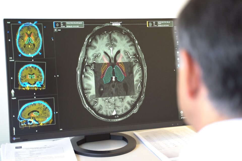 Un estudio de Harvard advierte sobre el tipo de alimentos que pueden aumentar el riesgo de Parkinson