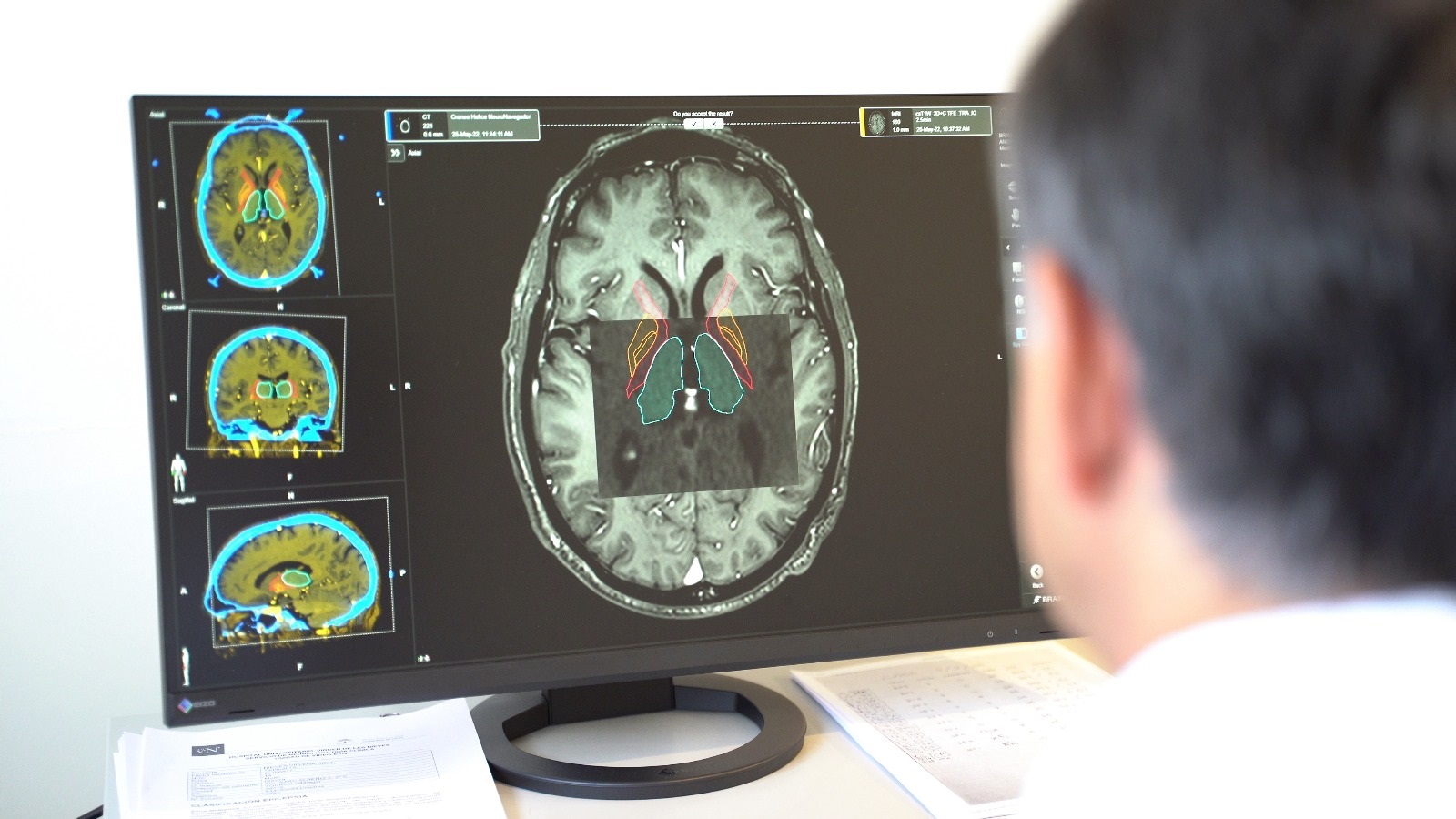 Un médico investigando sobre el párkinson en pacientes.