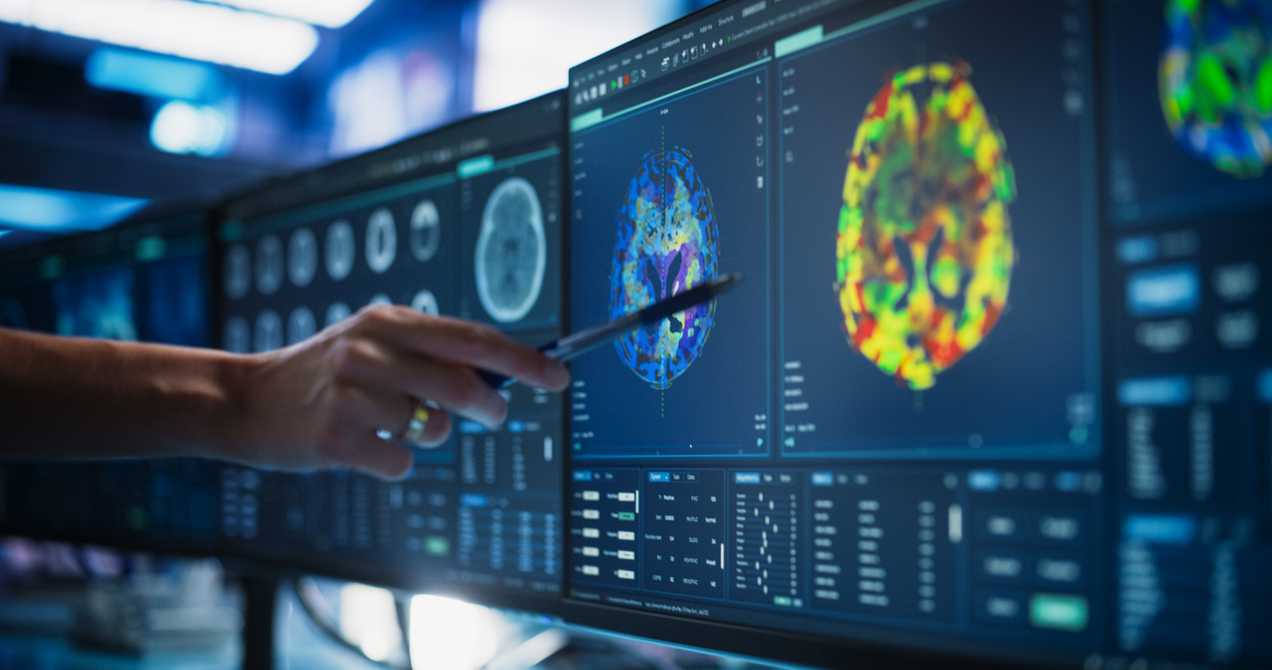 Varios de los signos y sintomas de la covid larga son de caracter psiquiatrico o neurologico.
